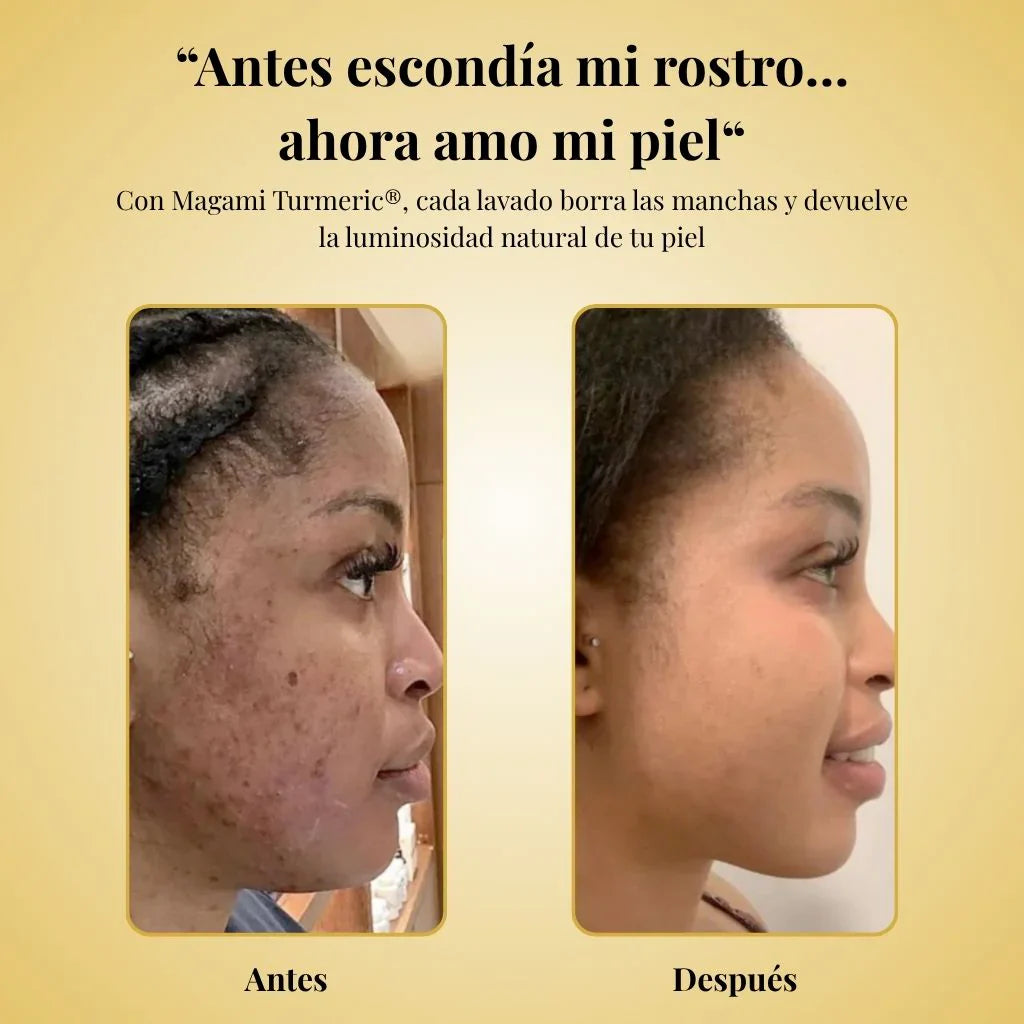 Jabón de Cúrcuma Natural 🧼🍂 ENVIO GRATIS